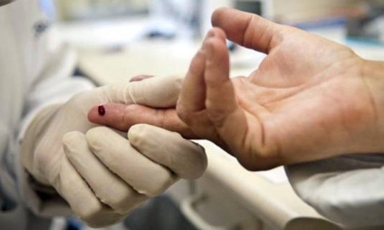 Remédio que previne contaminação pelo HIV será oferecido pelo SUS este mês