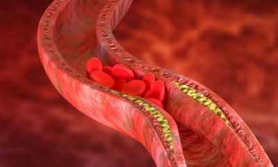 Meta de colesterol: saiba como ela deve ser definida e a importância do controle