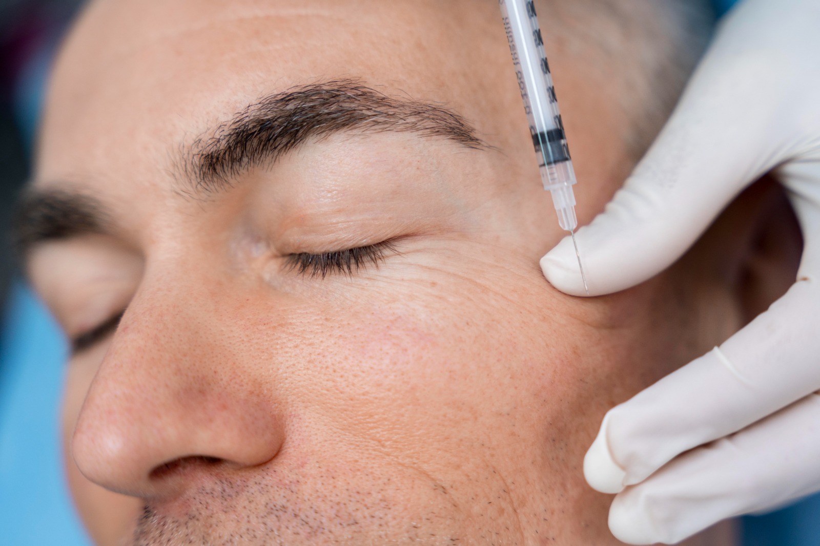 De botox a bioestimuladores de colágeno: saiba quais são os procedimentos faciais mais buscados pelos homens